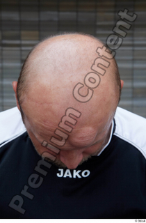Street  673 bald head 0003.jpg